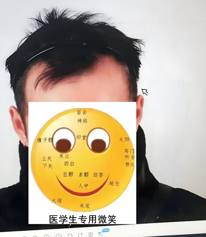 led和激光生发仪有啥区别深入解析